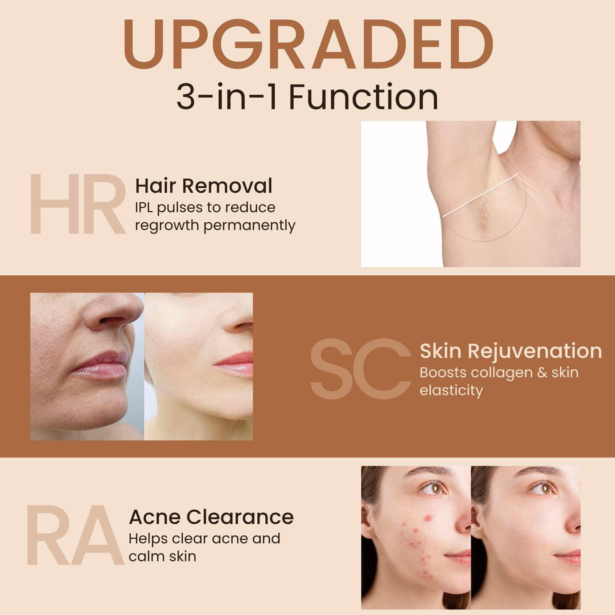 NEXSO IPL Hair Removal Device 5